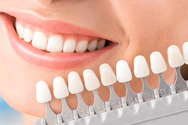 Есть ли побочные эффекты отбеливания зубов? Вы не знаете эти три очка